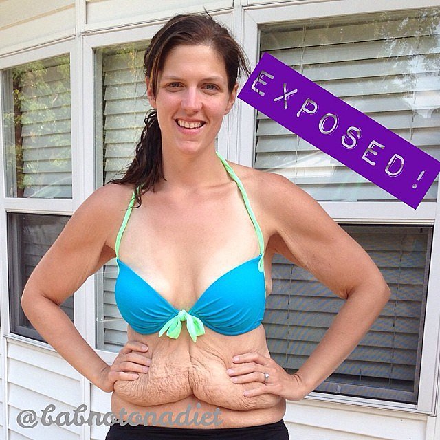 You may remember Brooke Birmingham's story from earlier this year. After refusing to send a photo of herself wearing a shirt — as requested for a before-and-after feature in Shape — she posted her reasons on her blog. "My body is real, not photoshopped or hidden because I feel like I should be ashamed. This is a body after losing 172 pounds, a body that has done amazing things, and looks AMAZING in a freaking bikini." Now Brooke is working with Shape to feature similar women who, like her, have lost a significant amount of weight.
You may remember Brooke Birmingham's story from earlier this year. After refusing to send a photo of herself wearing a shirt — as requested for a before-and-after feature in Shape — she posted her reasons on her blog. "My body is real, not photoshopped or hidden because I feel like I should be ashamed. This is a body after losing 172 pounds, a body that has done amazing things, and looks AMAZING in a freaking bikini." Now Brooke is working with Shape to feature similar women who, like her, have lost a significant amount of weight.