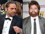 Zach Galifianakis Shows Off a Slimmer Look, Debuts Man Bun at SAG Awards Zach Galifianakis Shows Off a Slimmer Look, Debuts Man Bun at SAG Awards