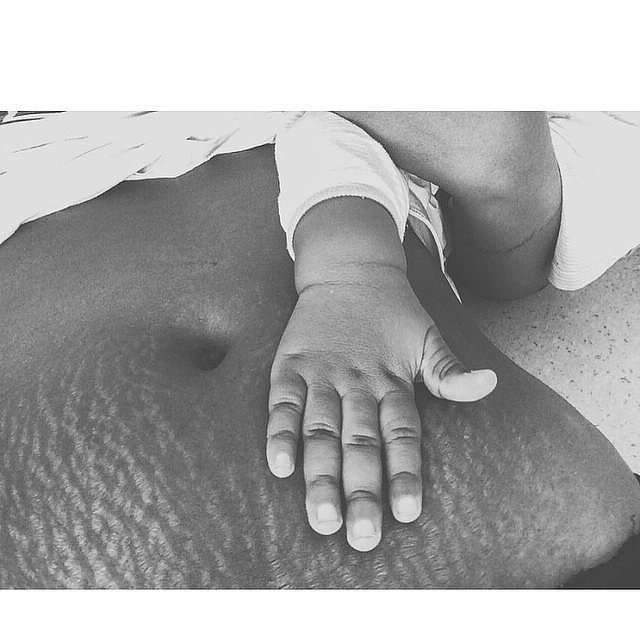 Photos Of Stretch Marks Love Your Lines Popsugar Beauty