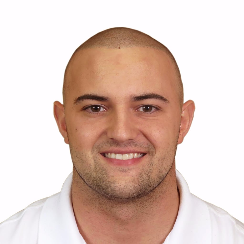 Hair Tattoos For Baldness | POPSUGAR Beauty