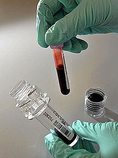 Why the Sight of Blood Makes You Feel Faint Why the Sight of Blood Makes You Feel Faint