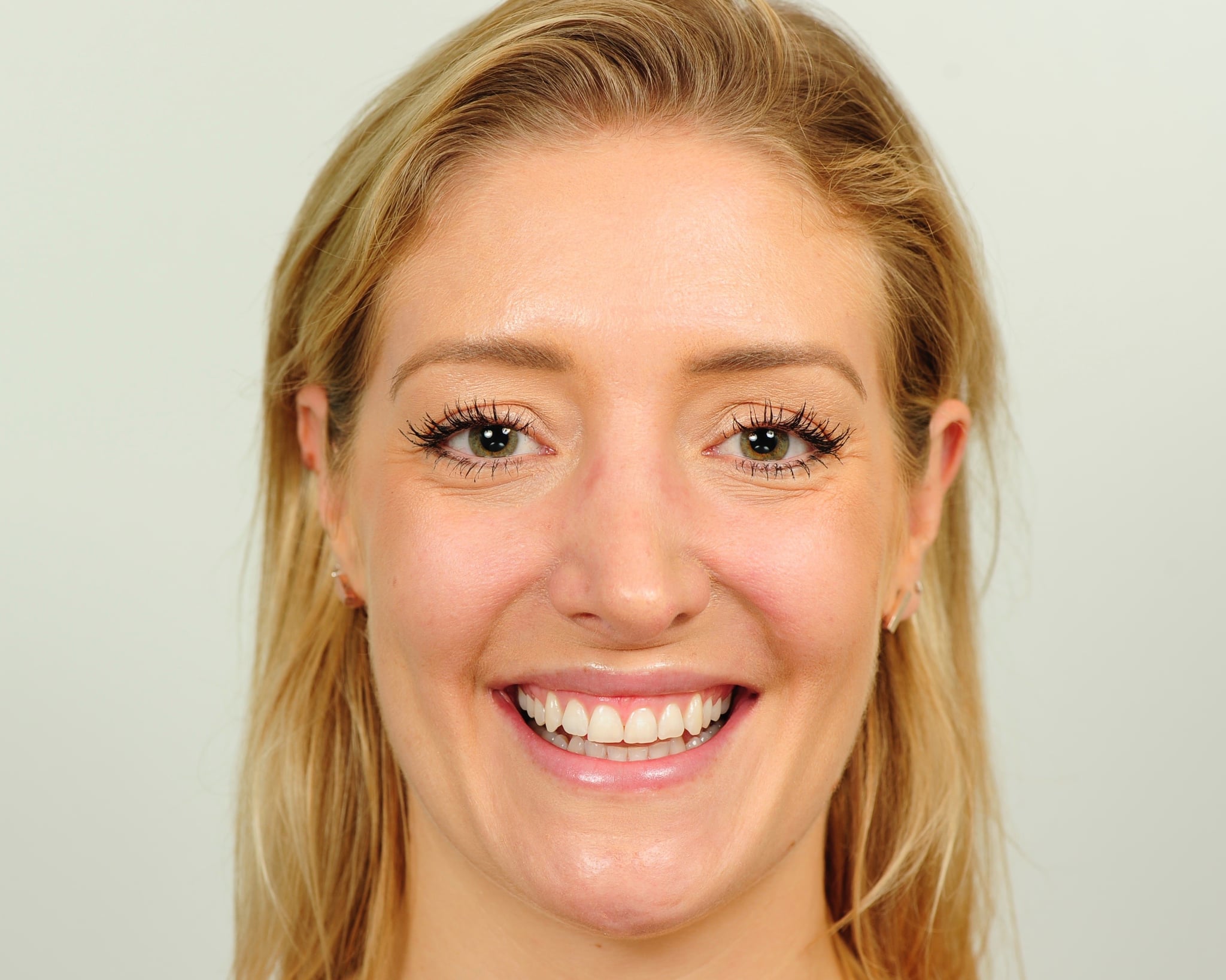 Teeth Whitening Diagram, Teeth, Free Engine Image For User Manual 